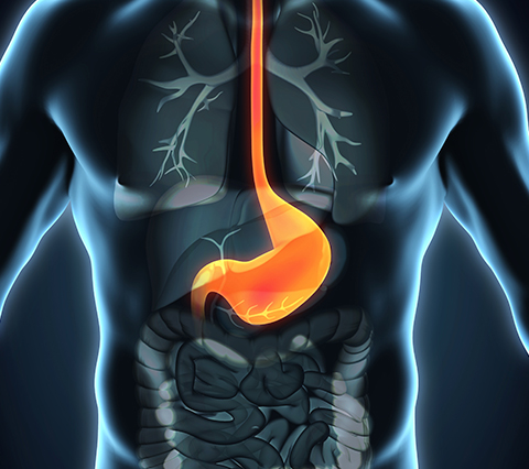 Problemas en sistema digestivo de un hombre que requieren manometra esofgica