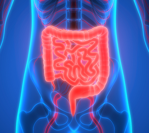 Estado de intestinos de paciente que requieren manometra rectal